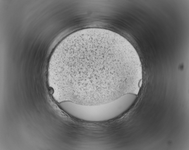 X0000114411138200911271520