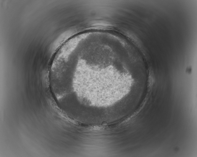 X0000114411362200911271516