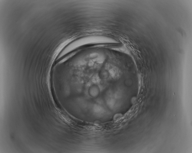 X0000114420147200910161236