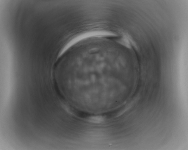 X0000114420161200910231213