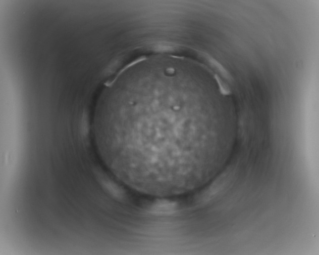 X0000114420257200910231212