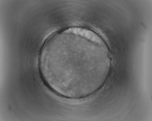 X0000114420010200911061632