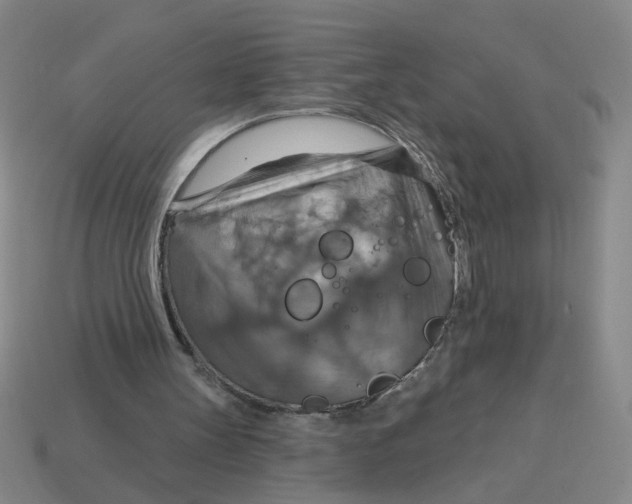 X0000114420147200911061629