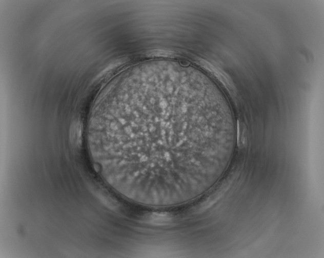 X0000114420157200911061629