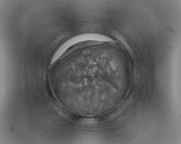 X0000114420161200911061629