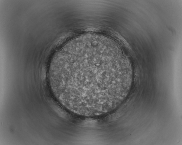 X0000114420257200911061628