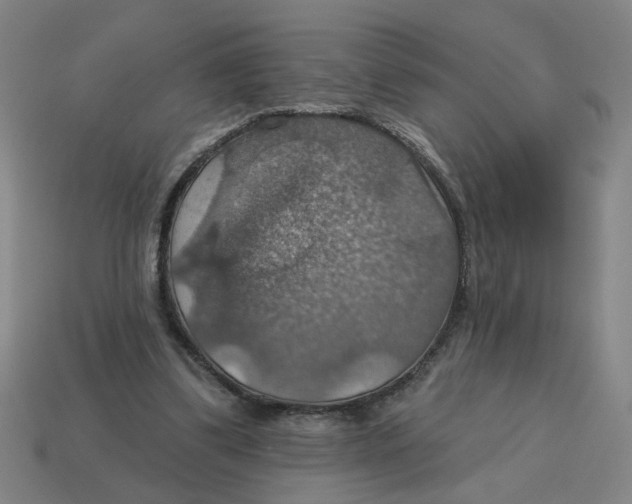 X0000114420299200911061628