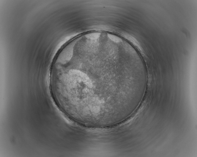 X0000114421040200911061618