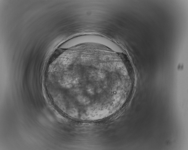 X0000114420145200911131458