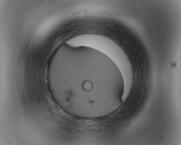 X0000114420146200911131458