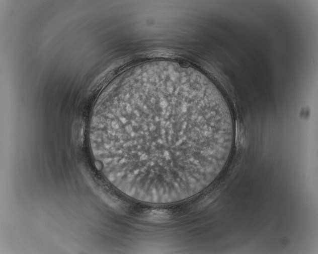 X0000114420157200911131458