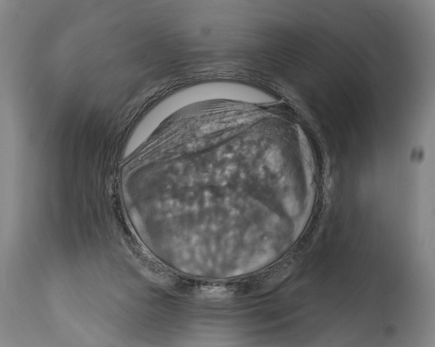 X0000114420161200911131458