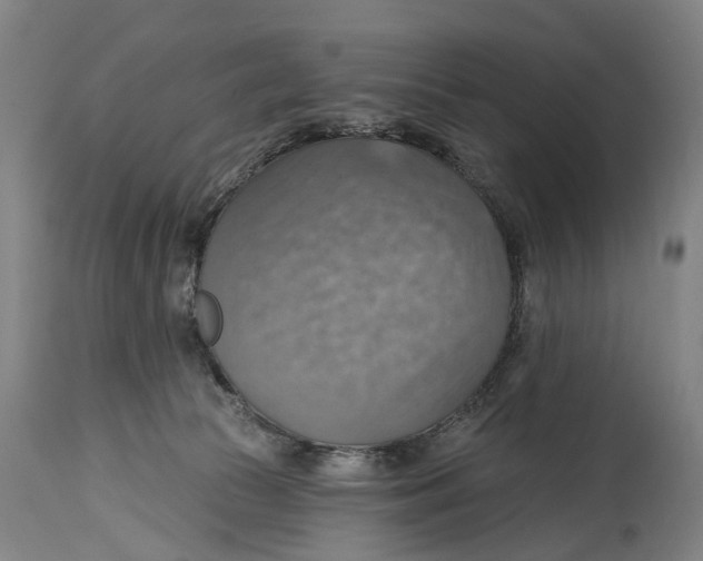 X0000114420177200911131459
