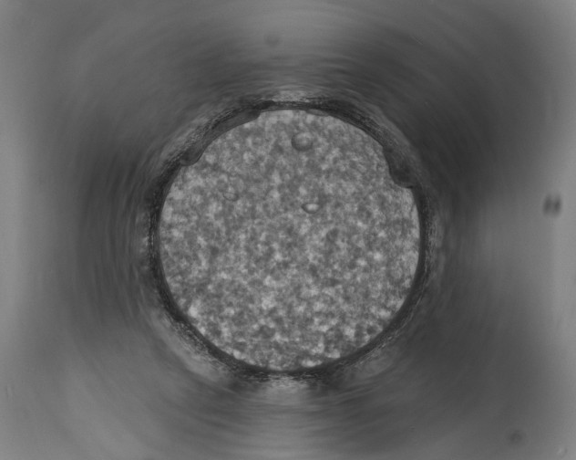 X0000114420257200911131457