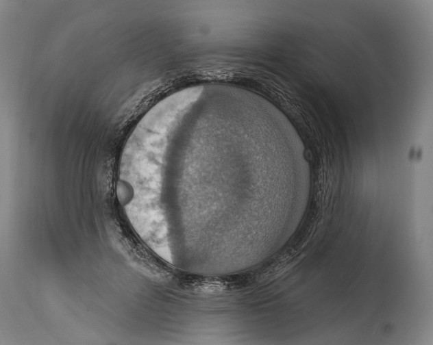 X0000114420600200911131452