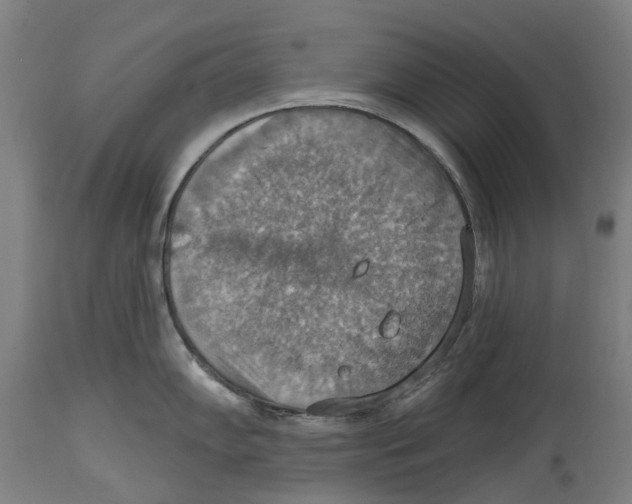 X0000114421102200911131445