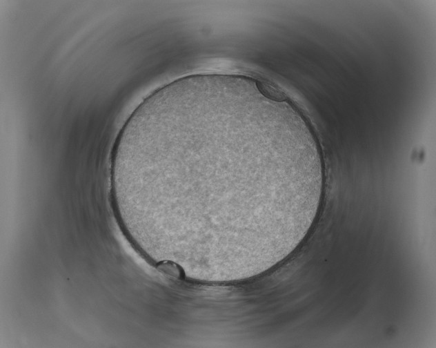 X0000114421479200911131440