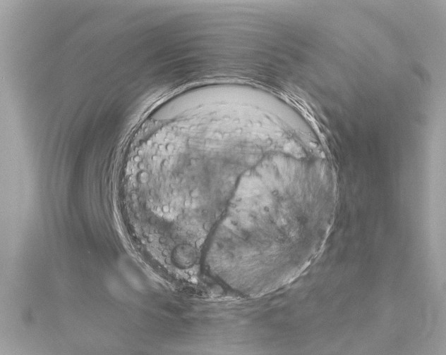 X0000114420145200911271604