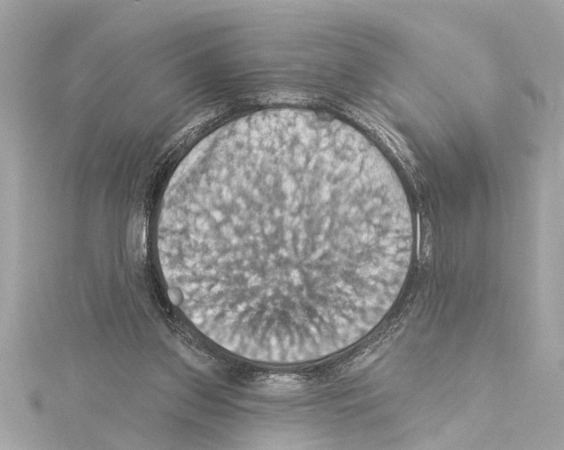X0000114420157200911271604