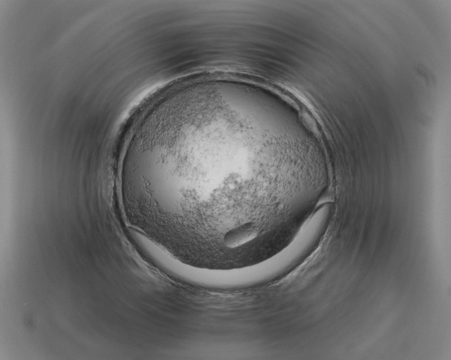 X0000114431115200911061637