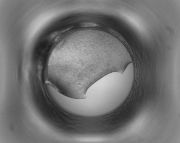 X0000114431151200911061638