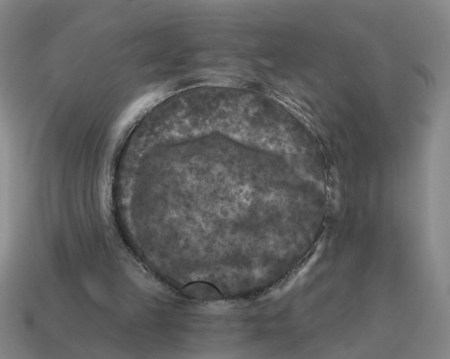 X0000114440149200911061711