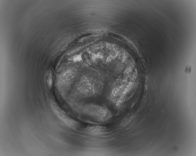 X0000114440069200911131525