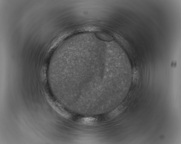 X0000114440158200911131523