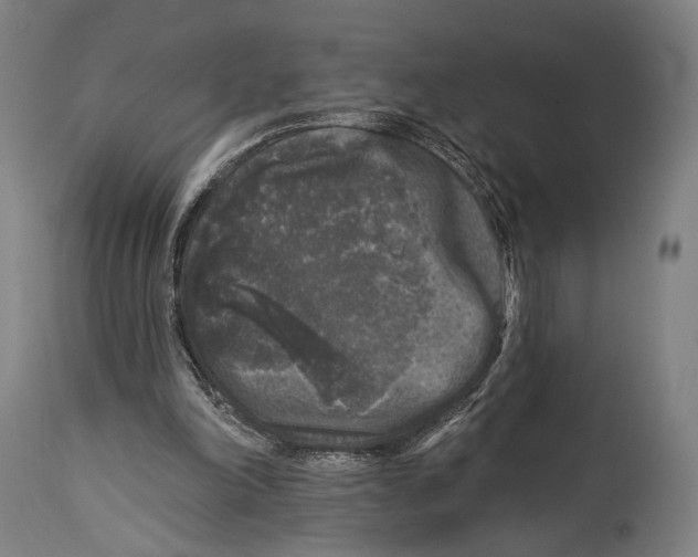 X0000114440198200911131523