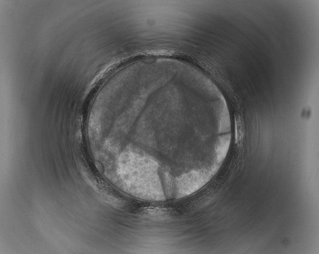 X0000114440300200911131522