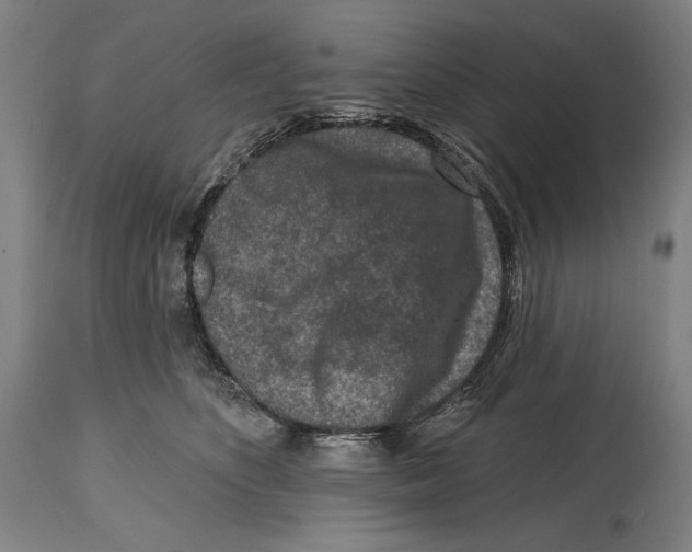 X0000114440516200911131518