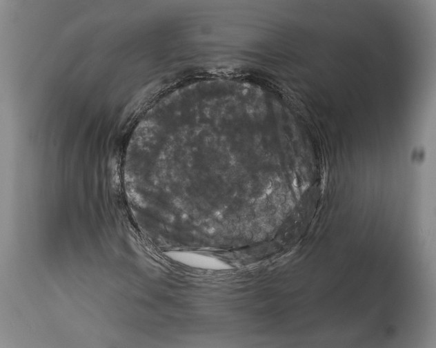 X0000114441106200911131509