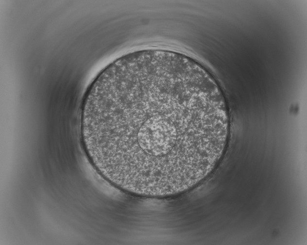 X0000114441514200911131504