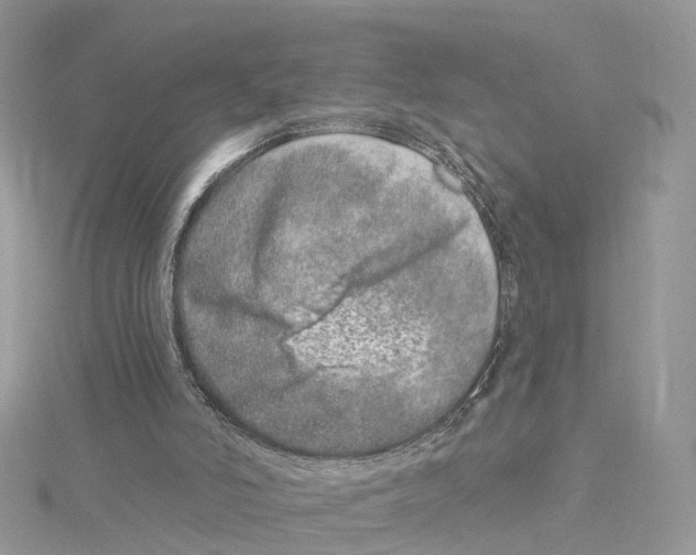 X0000114490006200911161222