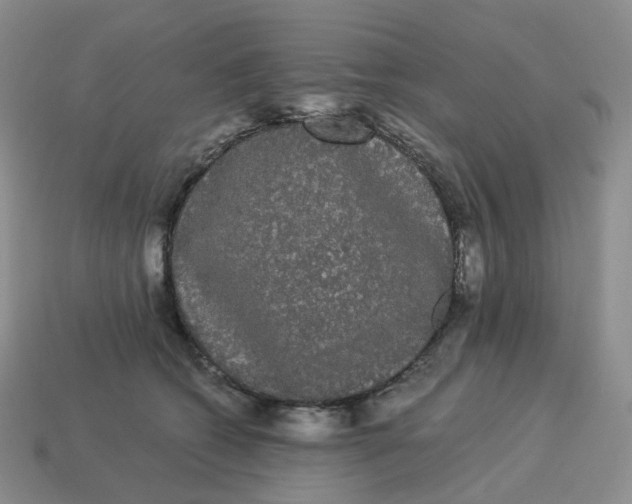 X0000114520562200911091153