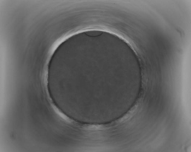 X0000114521519200911091140