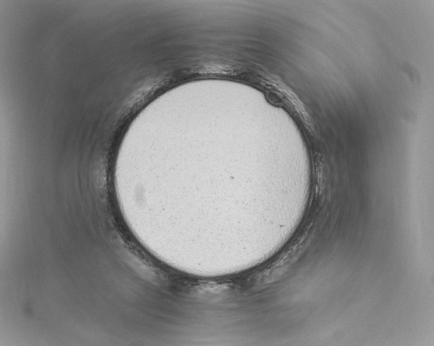 X0000114520257200911161322