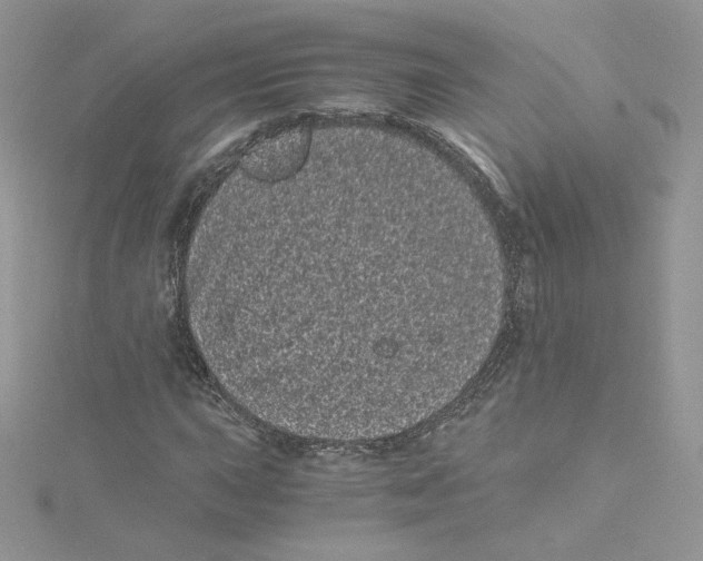 X0000114521015200911161311