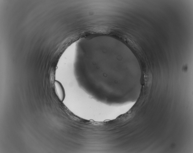 X0000114520143200911301125