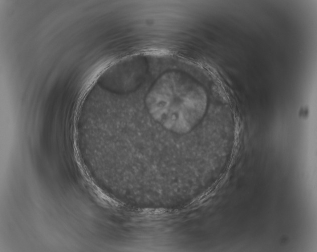 X0000114520145200911301124