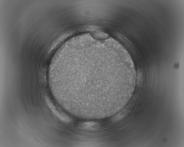 X0000114520158200911301124