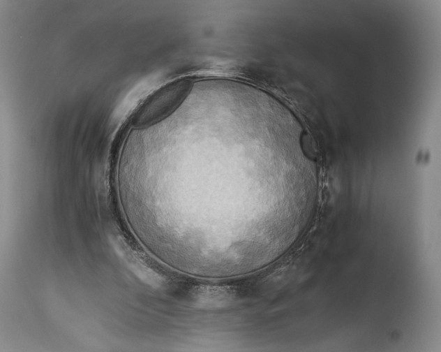 X0000114540296200911091139