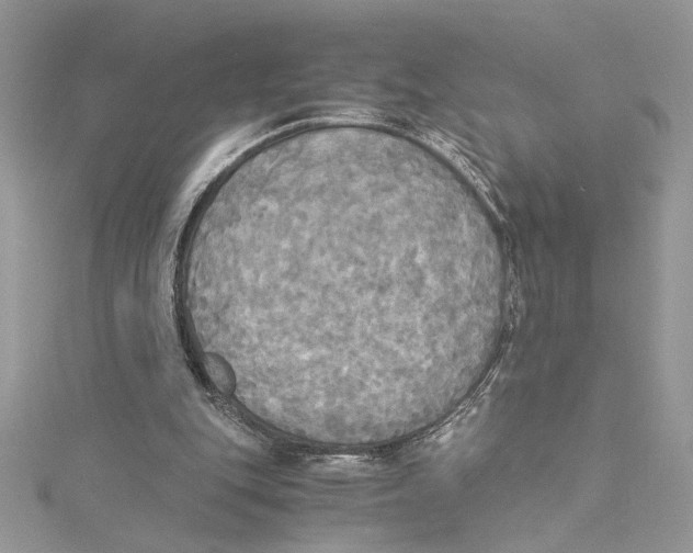 X0000114540151200911161405