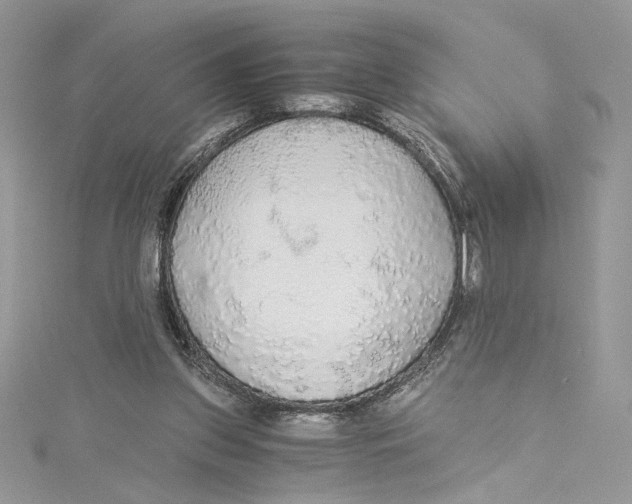 X0000114540157200911161405