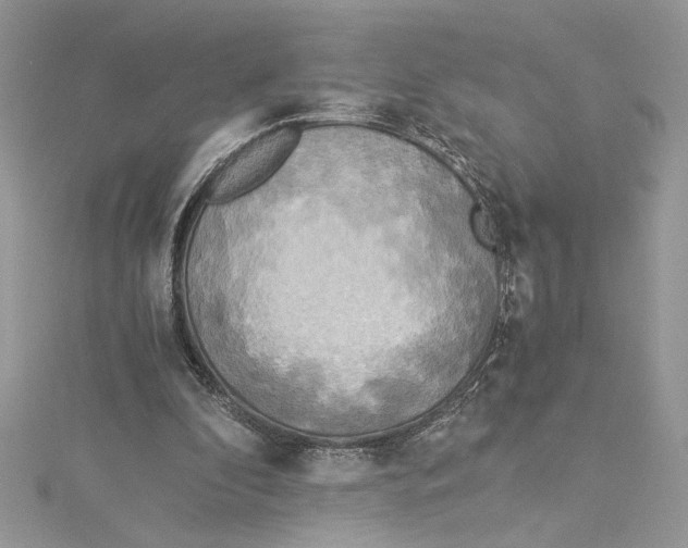 X0000114540296200911161403