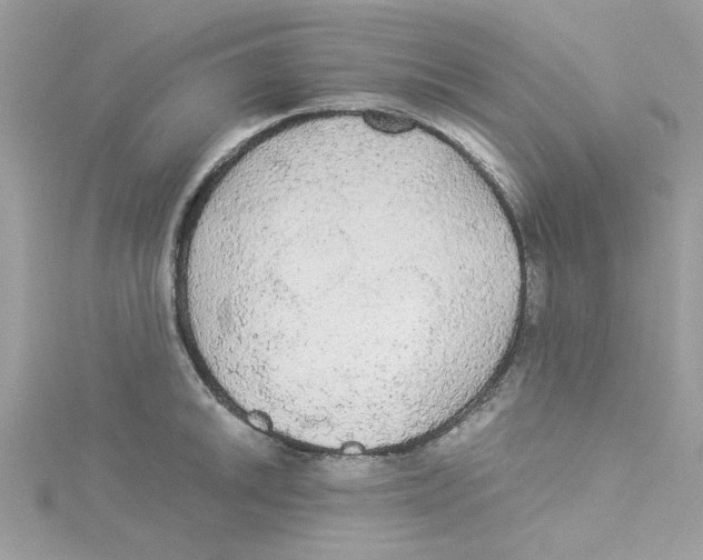 X0000114541046200911161353