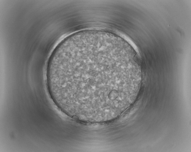 X0000114541099200911161352