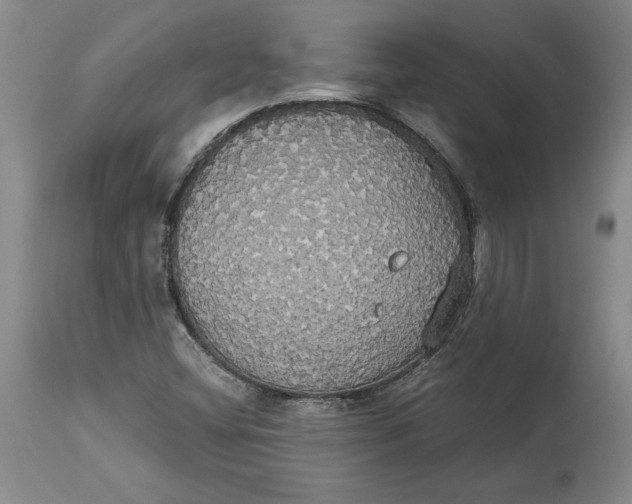 X0000114551404200911091145