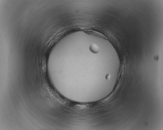 X0000114560170200911161232