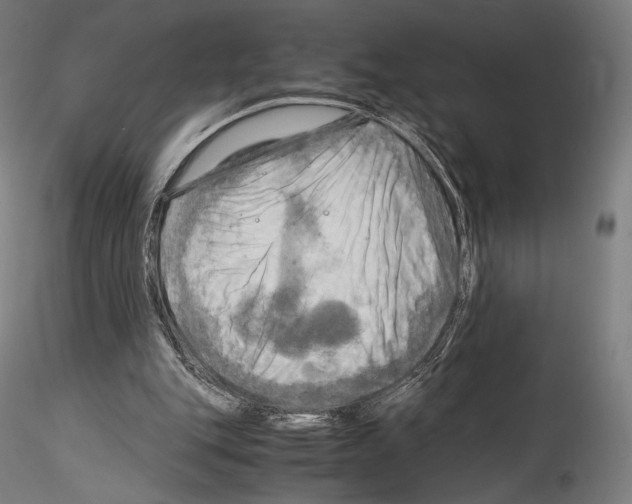 X0000114560151200911301256